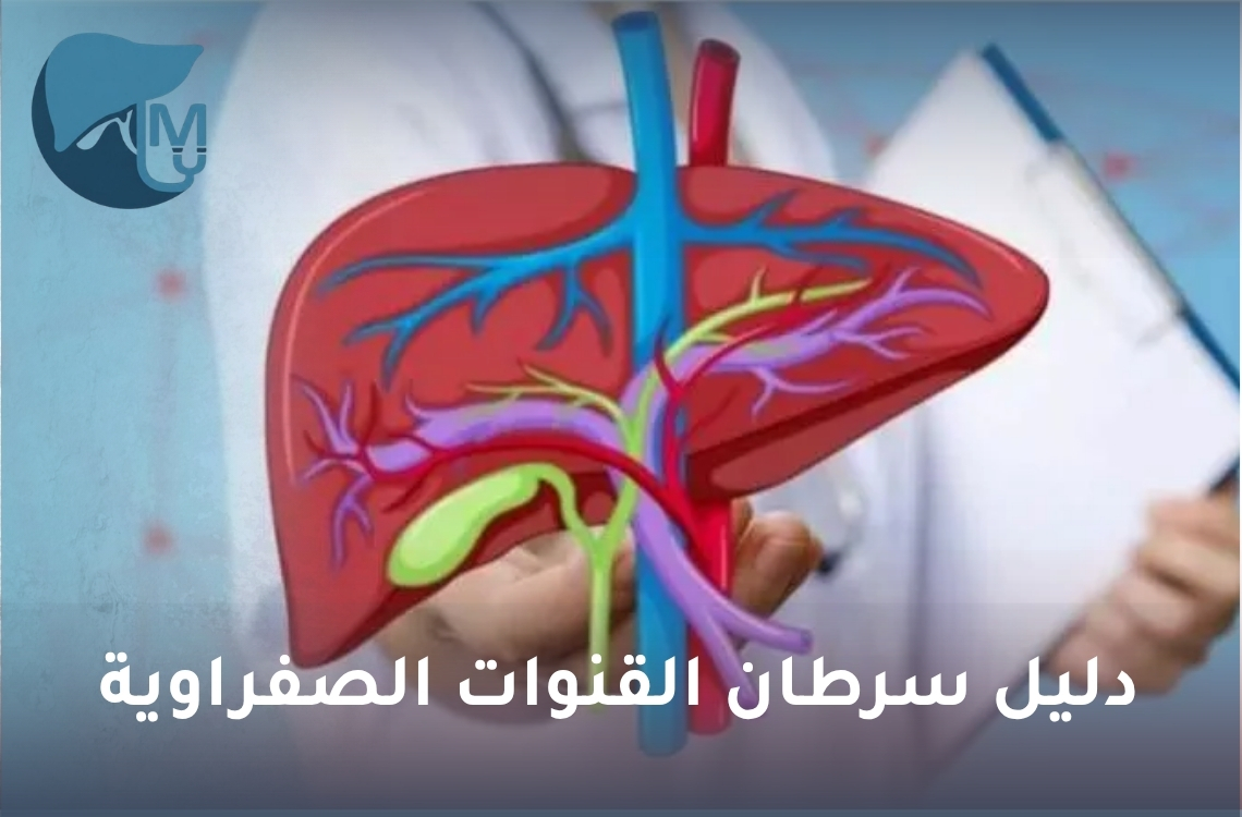 دليل سرطان القنوات الصفراوية: الأعراض والأسباب والمراحل وطرق العلاج