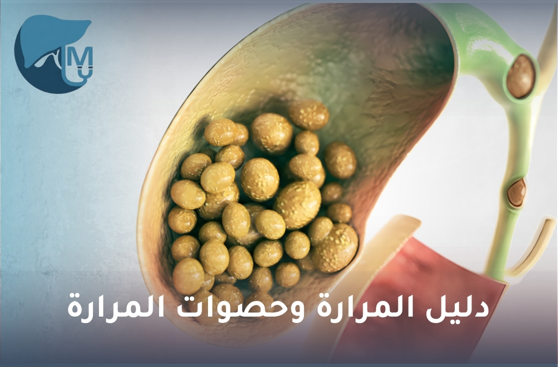 دليل المرارة وحصوات المرارة: الأعراض والعلاج واستئصال المرارة بالمنظار