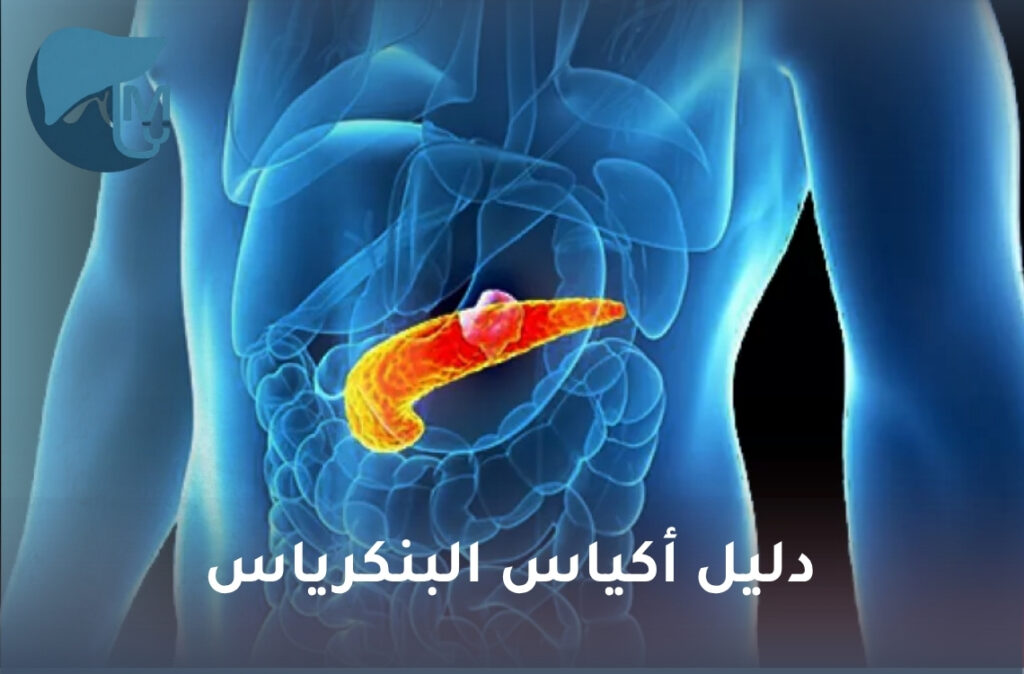 أكياس البنكرياس