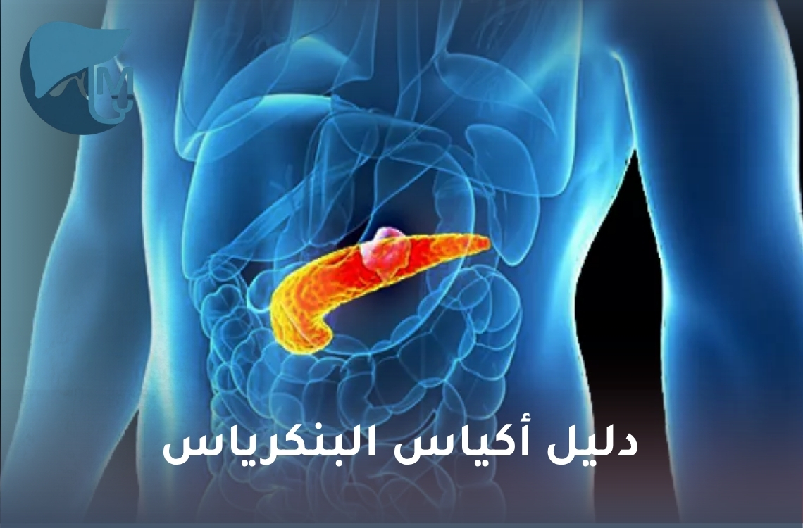 دليل أكياس البنكرياس: الأنواع والأعراض والأسباب وطرق العلاج