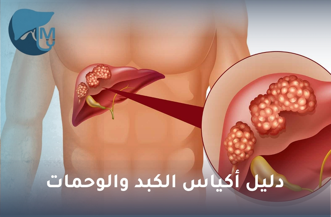 دليل أكياس الكبد والوحمات: الأنواع والأسباب وطرق العلاج