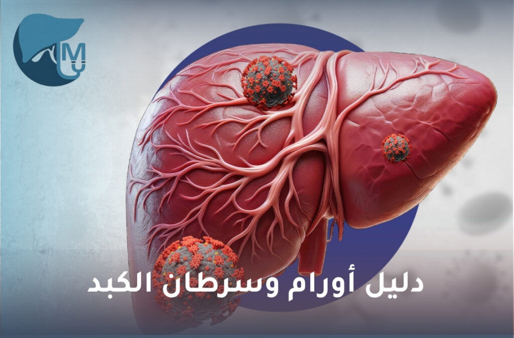 أورام وسرطان الكبد