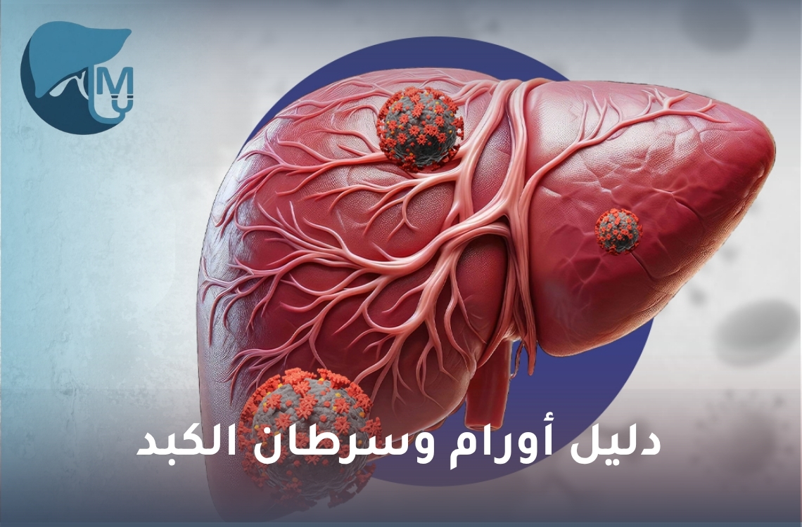 دليل أورام وسرطان الكبد: الأنواع والأعراض والعلاج ونسب الشفاء