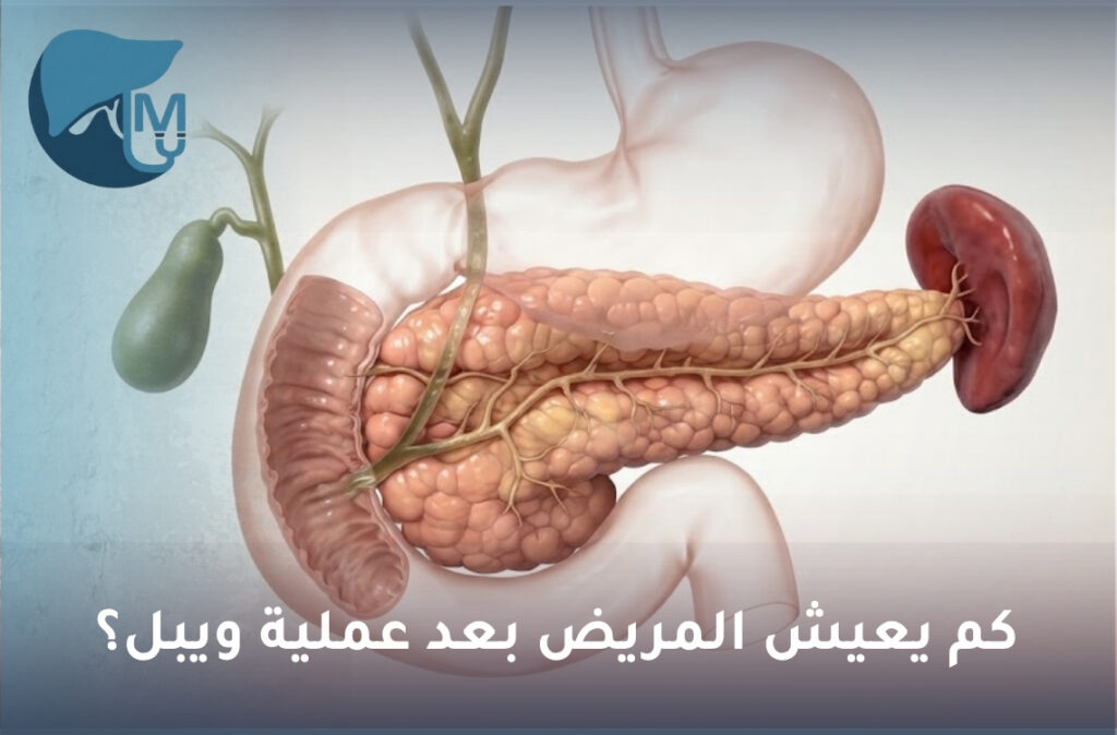 كم يعيش المريض بعد عملية ويبل