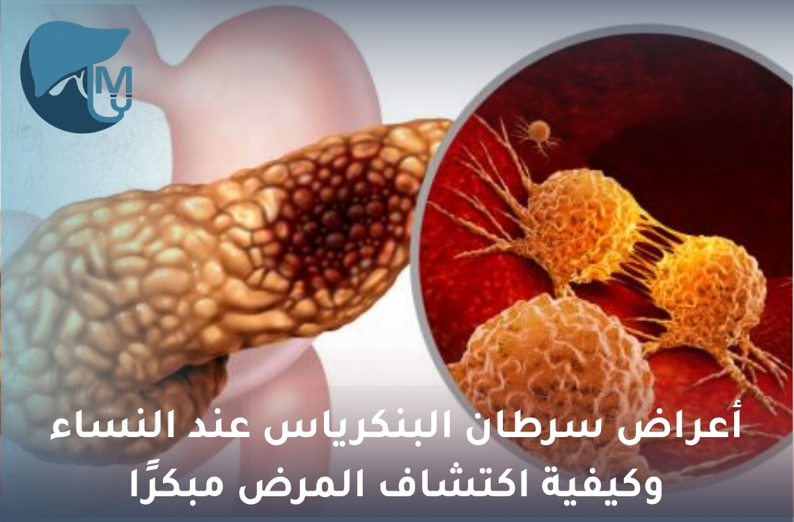 أعراض سرطان البنكرياس عند النساء وكيفية اكتشاف المرض مبكرًا