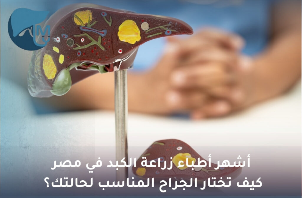 أسباب ظهور وحمة الكبد