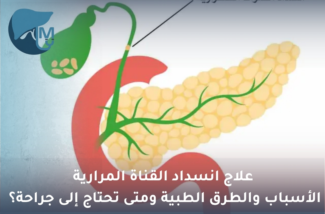 علاج انسداد القناة المرارية: الأسباب والطرق الطبية ومتى تحتاج إلى جراحة؟