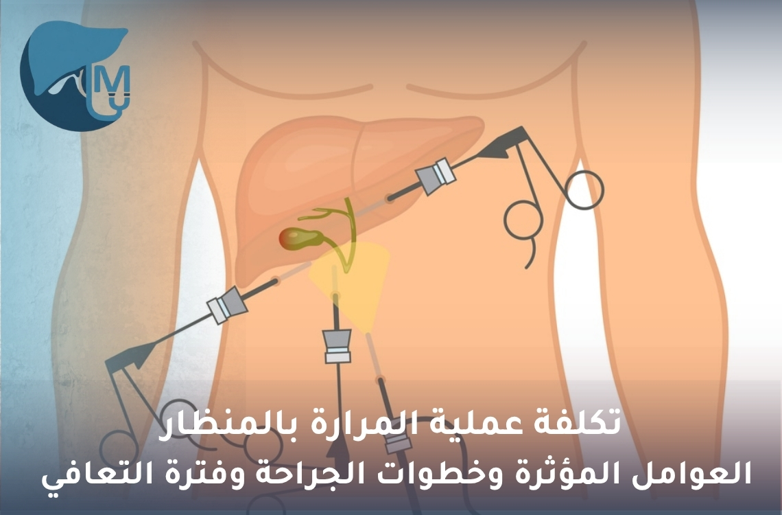 تكلفة عملية المرارة بالمنظار: العوامل المؤثرة وخطوات الجراحة وفترة التعافي