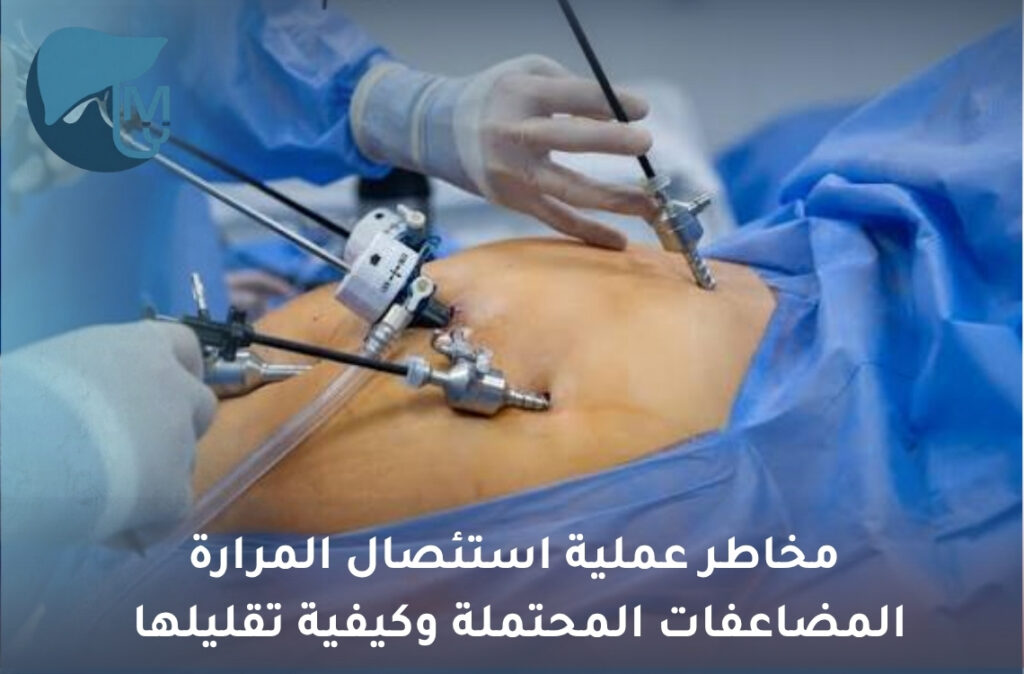مخاطر عملية استئصال المرارة